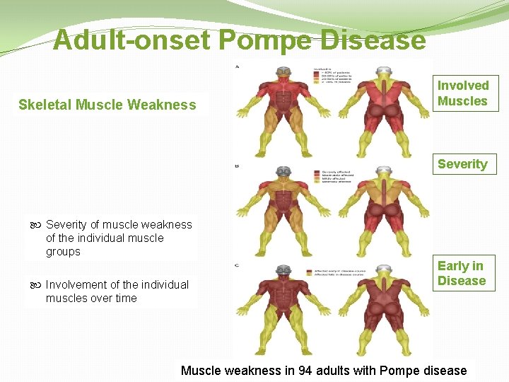 Adult-onset Pompe Disease Skeletal Muscle Weakness Involved Muscles Severity of muscle weakness of the