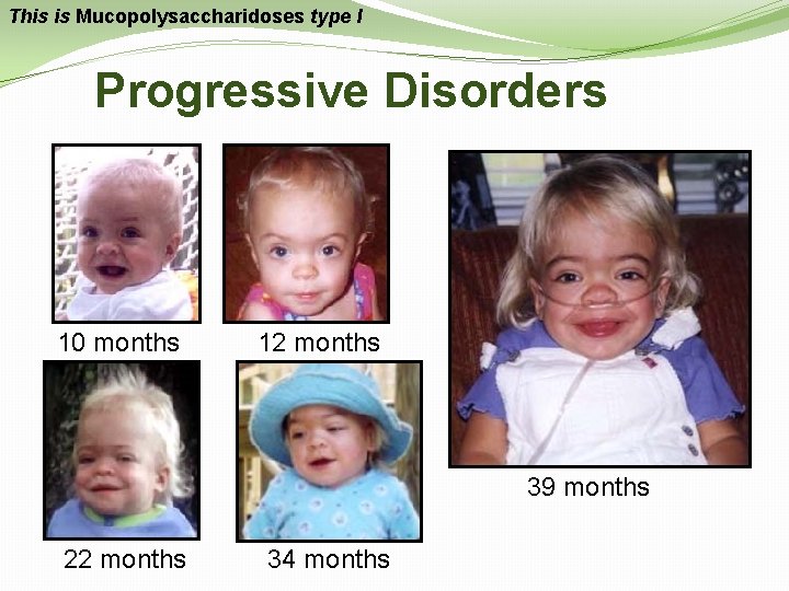 This is Mucopolysaccharidoses type I Progressive Disorders 10 months 12 months 39 months 22