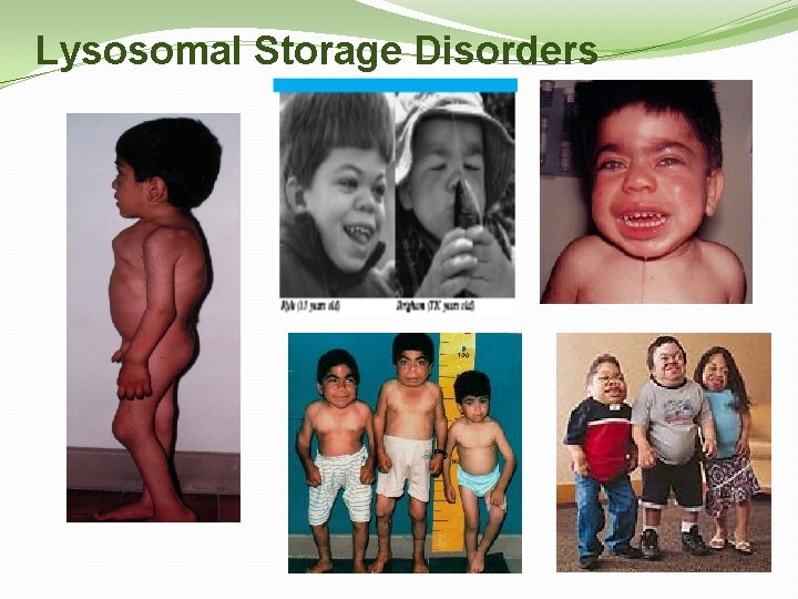 Lysosomal Storage Disorders 