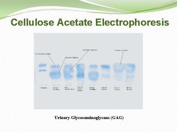 Cellulose Acetate Electrophoresis Urinary Glycosaminoglycans (GAG) 