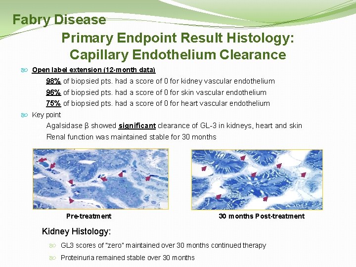 Fabry Disease Primary Endpoint Result Histology: Capillary Endothelium Clearance Open label extension (12 -month