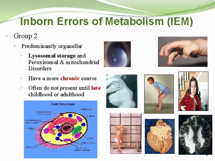 Inborn Errors of Metabolism (IEM) • Group 2 • Predominantly organellar • Lysosomal storage