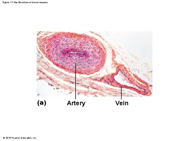 Figure 11. 10 a Structure of blood vessels. (a) © 2015 Pearson Education, Inc. Figure 11. 10 a Structure of blood vessels. (a) © 2015 Pearson Education, Inc.