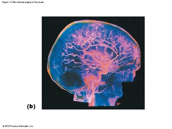 Figure 11. 15 b Arterial supply of the brain. (b) © 2015 Pearson Education, Figure 11. 15 b Arterial supply of the brain. (b) © 2015 Pearson Education,