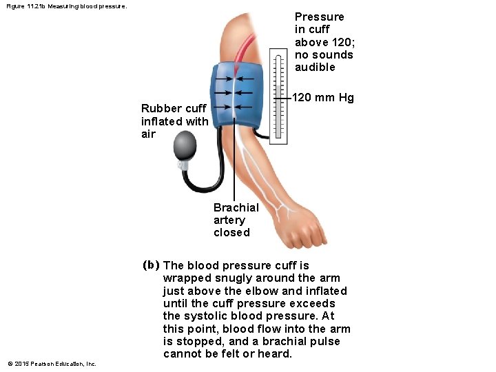 Figure 11. 21 b Measuring blood pressure. Pressure in cuff above 120; no sounds