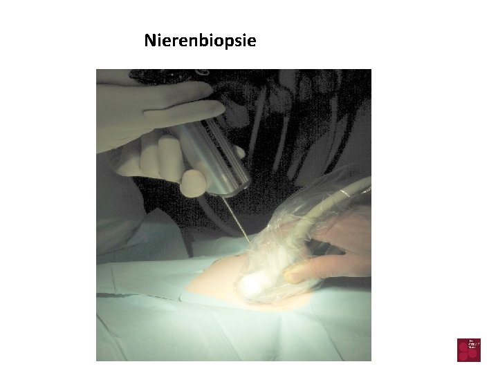 Nierenbiopsie 