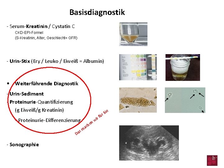 Basisdiagnostik - Serum-Kreatinin / Cystatin C CKD-EPI-Formel (S-Kreatinin, Alter, Geschlecht= GFR) - Urin-Stix (Ery