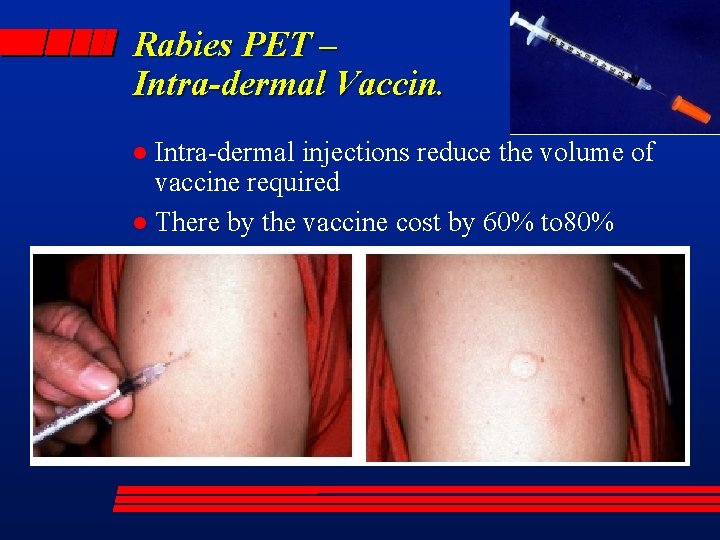 Rabies PET – Intra-dermal Vaccin. Intra-dermal injections reduce the volume of vaccine required l