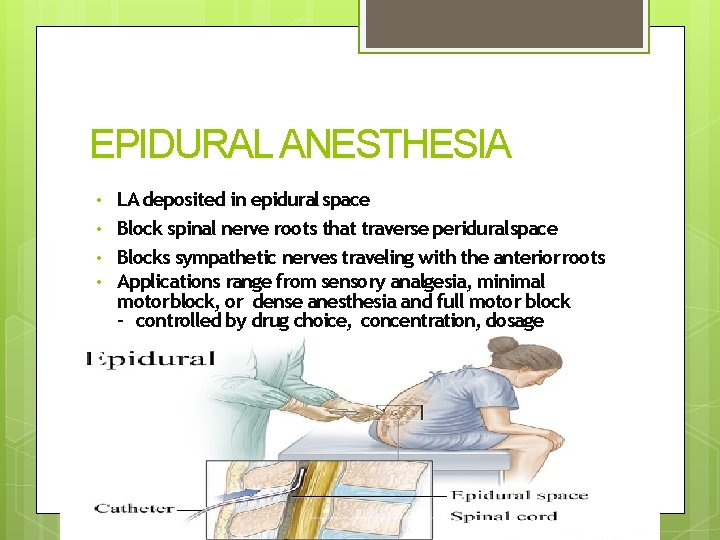 EPIDURAL ANESTHESIA • • LA deposited in epidural space Block spinal nerve roots that