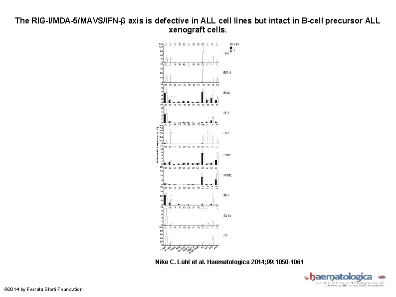 The RIG-I/MDA-5/MAVS/IFN-β axis is defective in ALL cell lines but intact in B-cell precursor