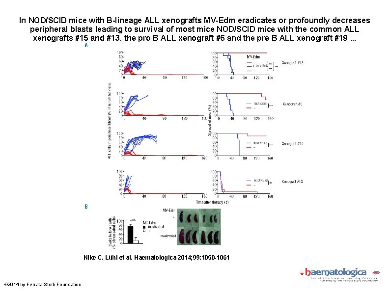 In NOD/SCID mice with B-lineage ALL xenografts MV-Edm eradicates or profoundly decreases peripheral blasts