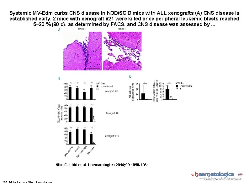 Systemic MV-Edm curbs CNS disease In NOD/SCID mice with ALL xenografts (A) CNS disease
