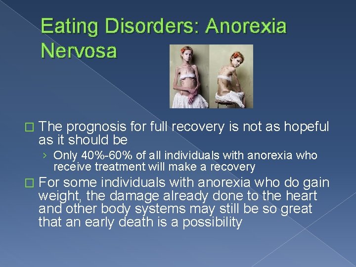 Eating Disorders: Anorexia Nervosa � The prognosis for full recovery is not as hopeful