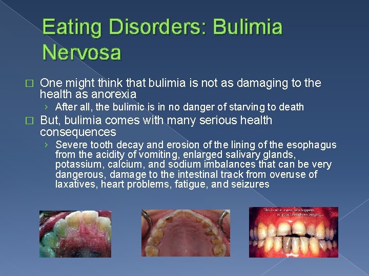 Eating Disorders: Bulimia Nervosa � One might think that bulimia is not as damaging