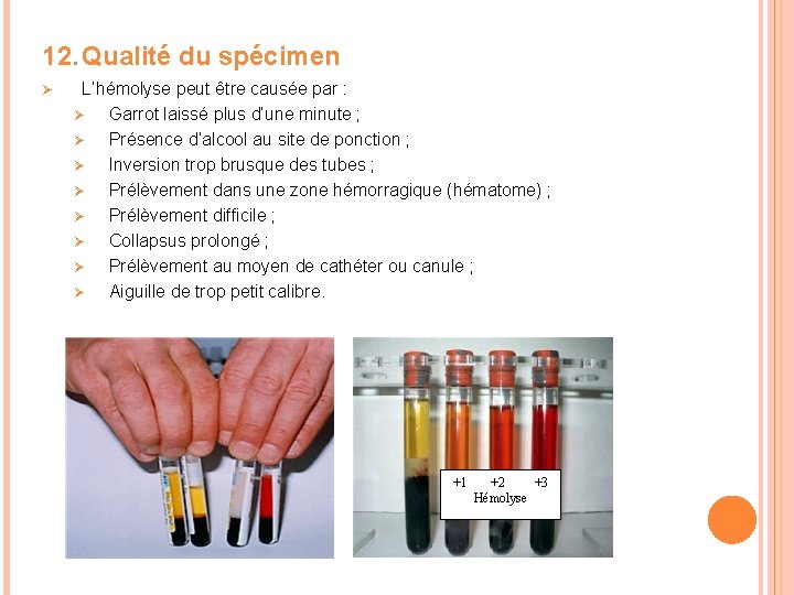 12. Qualité du spécimen Ø L’hémolyse peut être causée par : Ø Garrot laissé