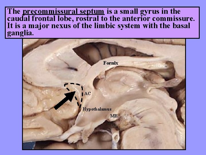 The precommissural septum is a small gyrus in the caudal frontal lobe, rostral to