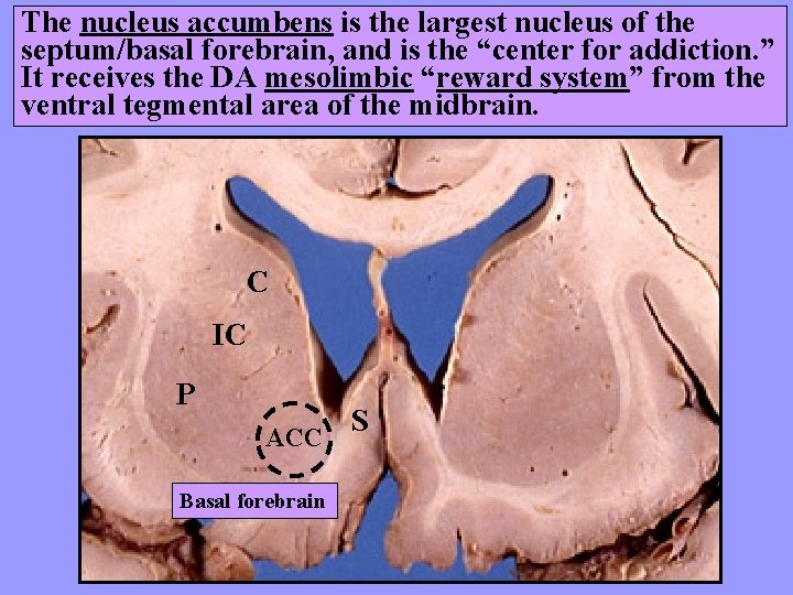 The nucleus accumbens is the largest nucleus of the septum/basal forebrain, and is the