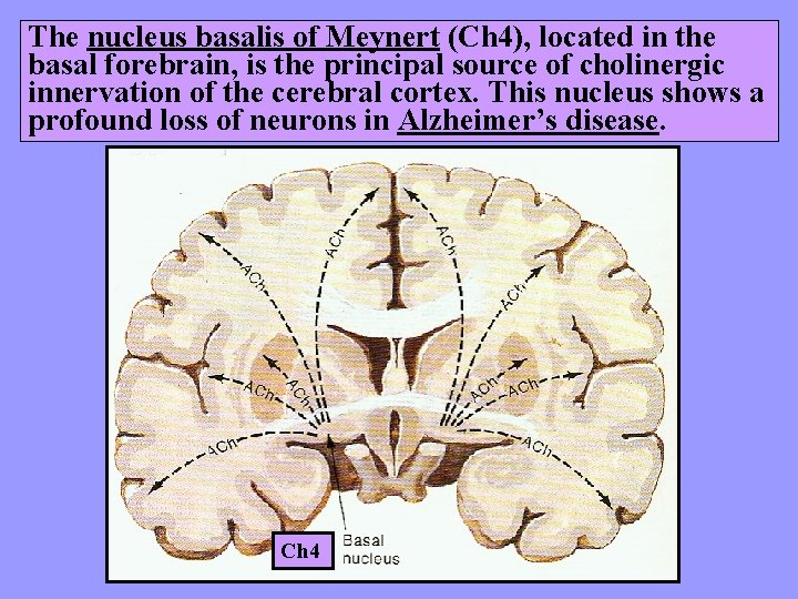 The nucleus basalis of Meynert (Ch 4), located in the basal forebrain, is the