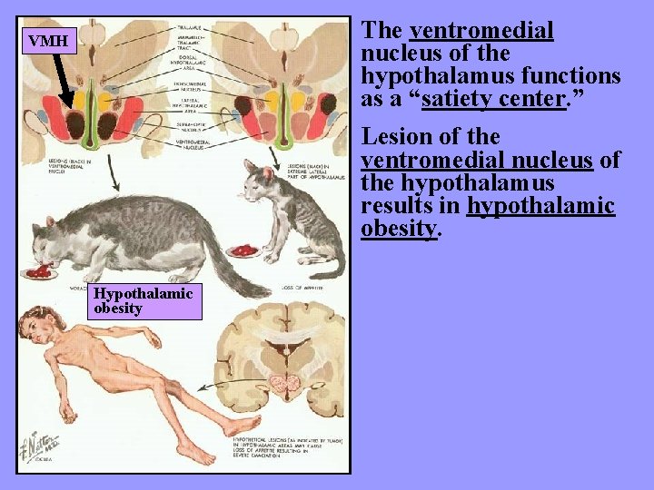 The ventromedial nucleus of the hypothalamus functions as a “satiety center. ” VMH Lesion