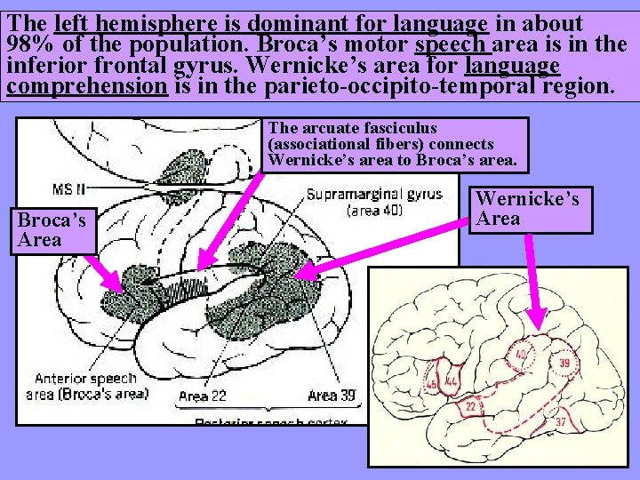 The left hemisphere is dominant for language in about 98% of the population. Broca’s