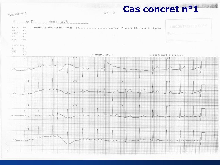 Cas concret n° 1 17 