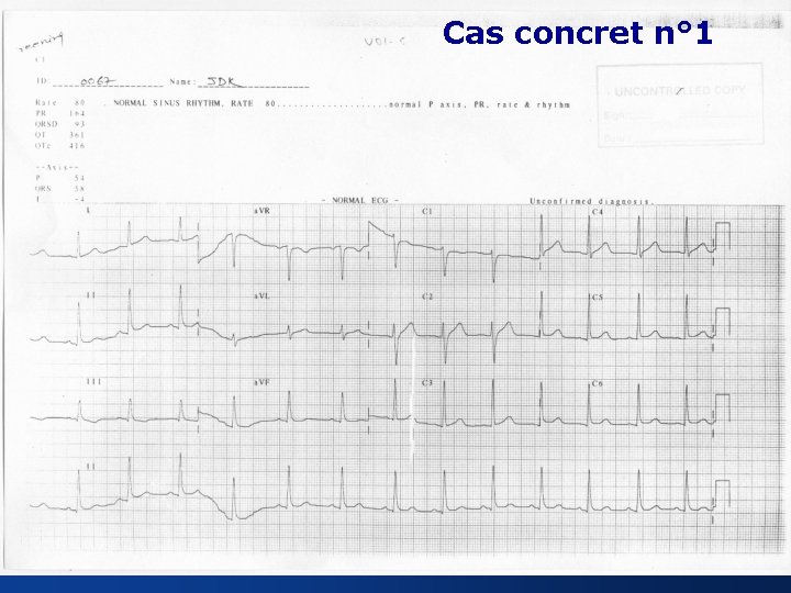 Cas concret n° 1 18 