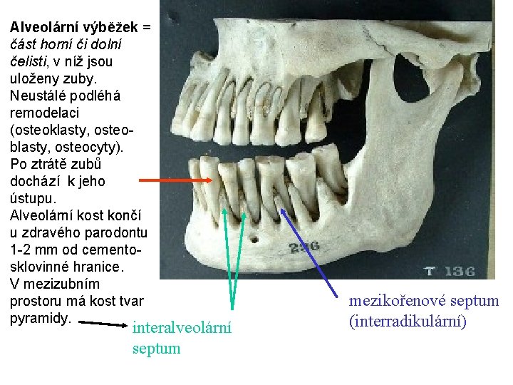 Alveolární výběžek = část horní či dolní čelisti, v níž jsou uloženy zuby. Neustálé