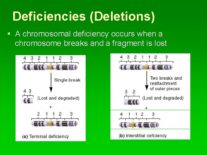 Deficiencies (Deletions) § A chromosomal deficiency occurs when a chromosome breaks and a fragment