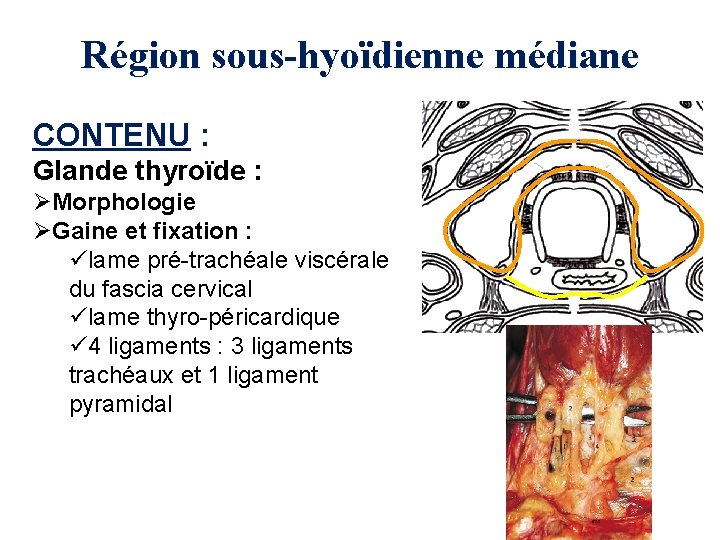 Région sous-hyoïdienne médiane CONTENU : Glande thyroïde : ØMorphologie ØGaine et fixation : ülame