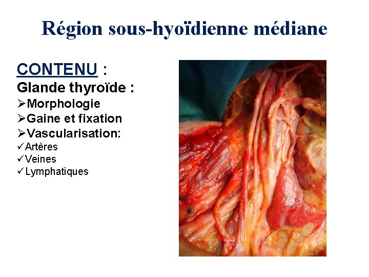 Région sous-hyoïdienne médiane CONTENU : Glande thyroïde : ØMorphologie ØGaine et fixation ØVascularisation: üArtères