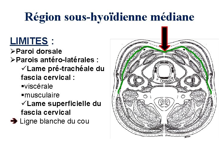 Région sous-hyoïdienne médiane LIMITES : ØParoi dorsale ØParois antéro-latérales : üLame pré-trachéale du fascia