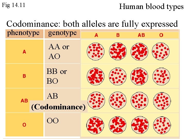 Fig 14. 11 Human blood types Codominance: both alleles are fully expressed phenotype genotype