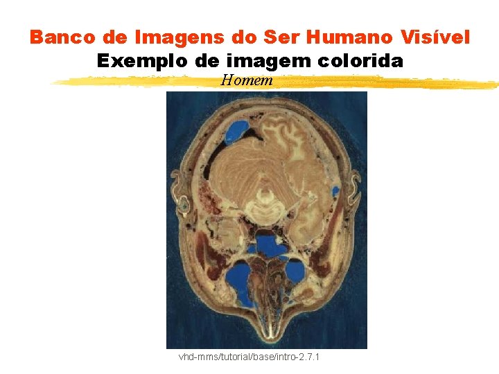 Banco de Imagens do Ser Humano Visível Exemplo de imagem colorida Homem vhd-mms/tutorial/base/intro-2. 7.