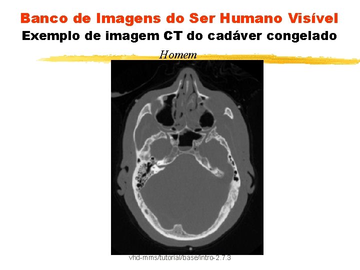 Banco de Imagens do Ser Humano Visível Exemplo de imagem CT do cadáver congelado