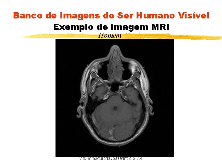Banco de Imagens do Ser Humano Visível Exemplo de imagem MRI Homem vhd-mms/tutorial/base/intro-2. 7.