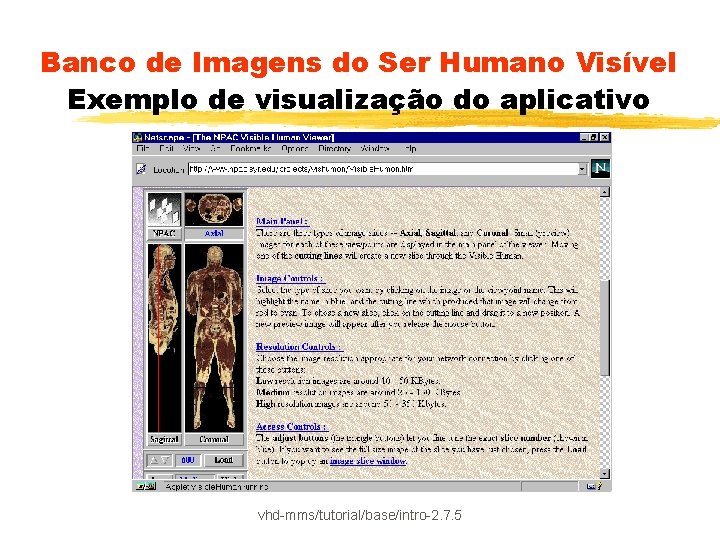 Banco de Imagens do Ser Humano Visível Exemplo de visualização do aplicativo vhd-mms/tutorial/base/intro-2. 7.