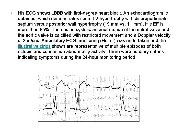  • His ECG shows LBBB with first-degree heart block. An echocardiogram is obtained,