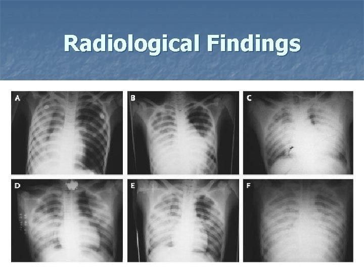 Radiological Findings 