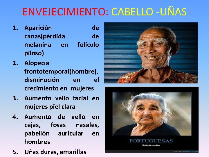 ENVEJECIMIENTO: CABELLO -UÑAS 1. Aparición de canas(pèrdida de melanina en folículo piloso) 2. Alopecia