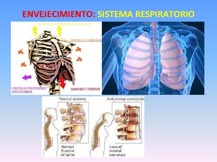 ENVEJECIMIENTO: SISTEMA RESPIRATORIO 