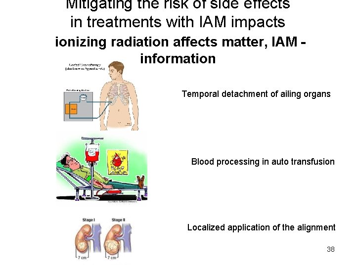 Mitigating the risk of side effects in treatments with IAM impacts ionizing radiation affects