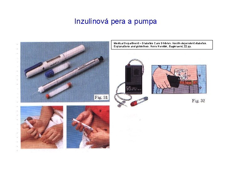 Inzulínová pera a pumpa Medical Department – Diabetes Care Division. Insulin dependent diabetes. Explanations