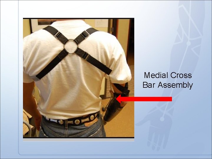 Medial Cross Bar Assembly 