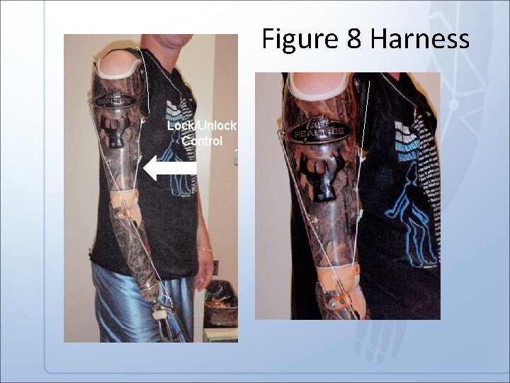 Figure 8 Harness Lock/Unlock Control 