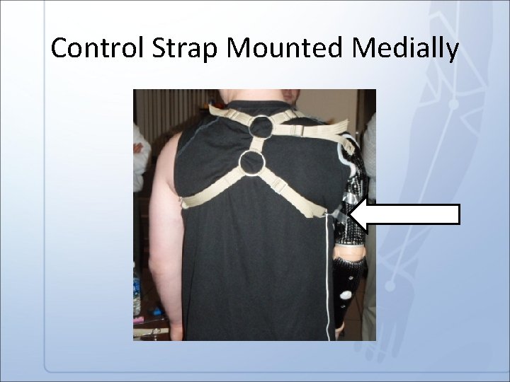 Control Strap Mounted Medially 