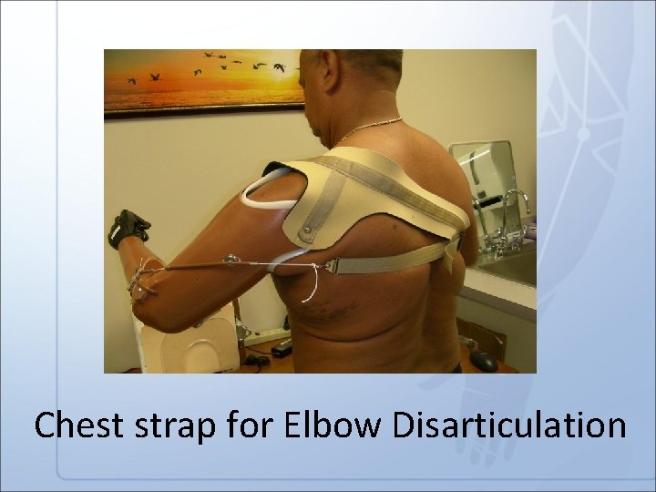 Chest strap for Elbow Disarticulation 