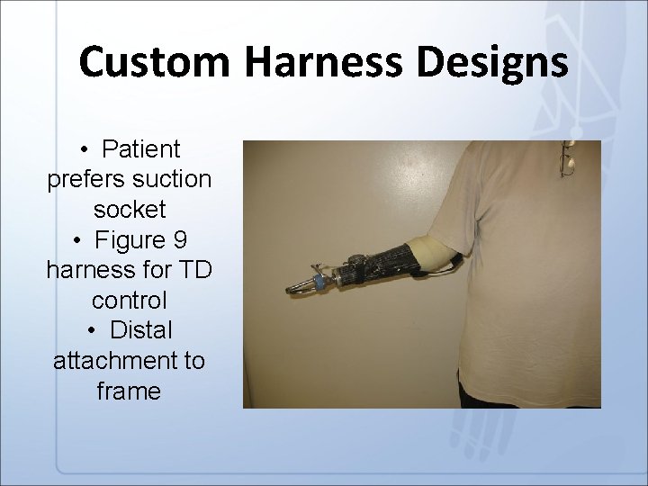 Custom Harness Designs • Patient prefers suction socket • Figure 9 harness for TD