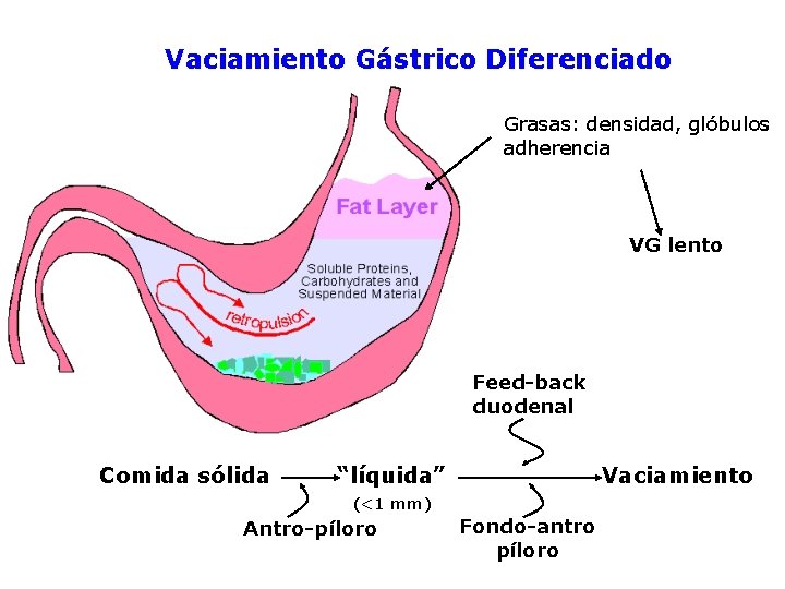 Vaciamiento Gástrico Diferenciado Grasas: densidad, glóbulos adherencia VG lento Feed-back duodenal Comida sólida “líquida”