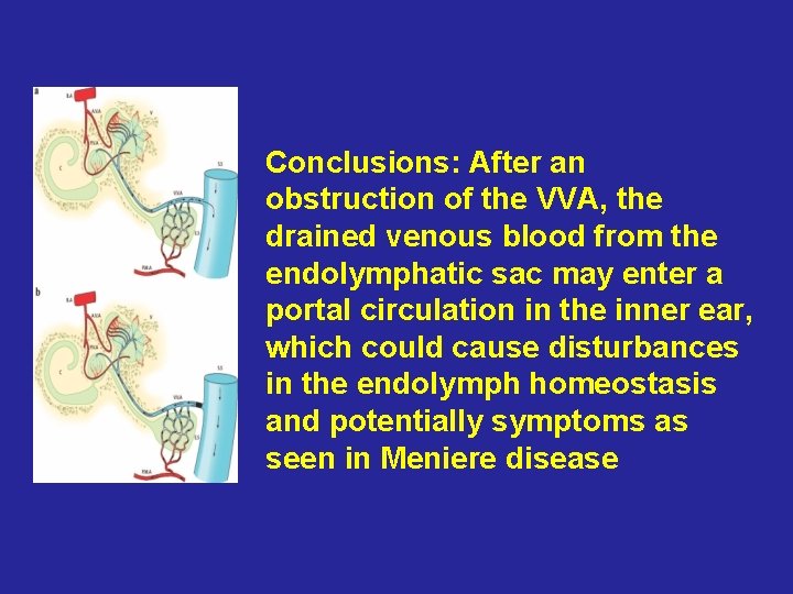 Conclusions: After an obstruction of the VVA, the drained venous blood from the endolymphatic