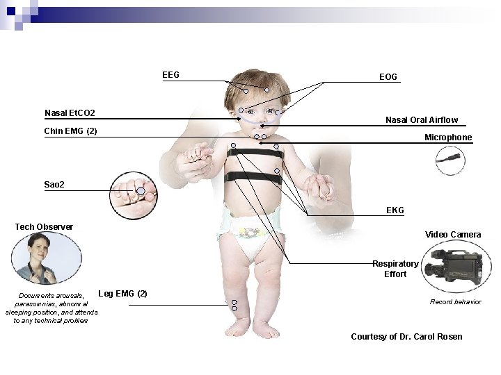 EEG Nasal Et. CO 2 EOG Nasal Oral Airflow Chin EMG (2) Microphone Sao